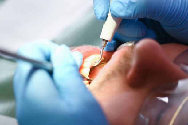Best Emergency Treatment for Toothache in Ferndale, MD