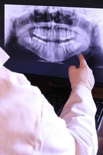 Best Emergency Tooth Extraction in Ferndale, MD